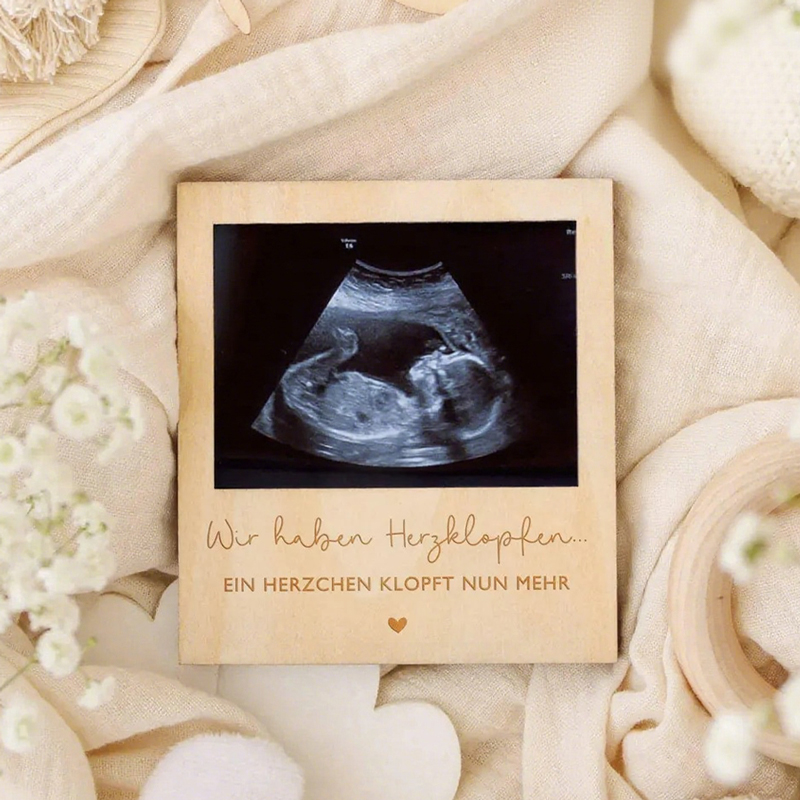 Ultrasound Pregnancy Announcem - đánh giá và giá Photo Booth Frame