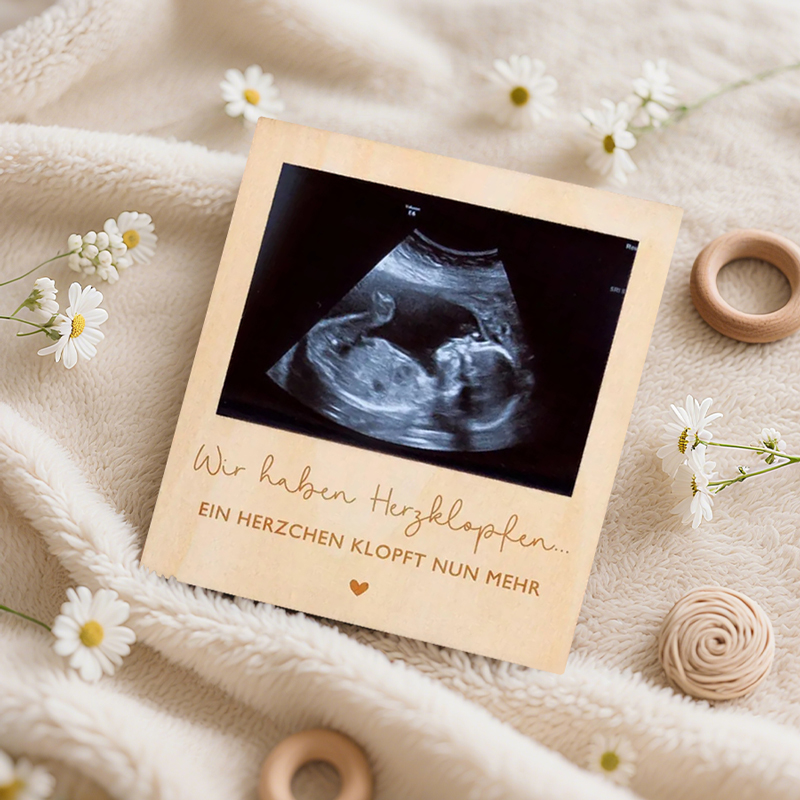 Ultrasound Pregnancy Announcem - đánh giá và giá Photo Booth Frame